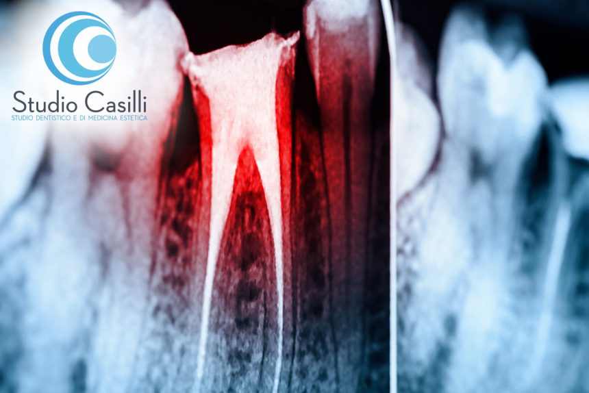 Endodonzia